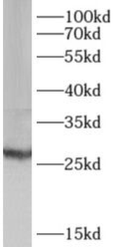 AK3 Rabbit Polyclonal Antibody