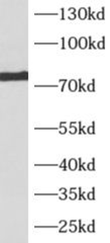 AKAP10 Antibody