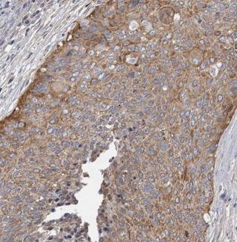 AKAP10 Rabbit Polyclonal Antibody