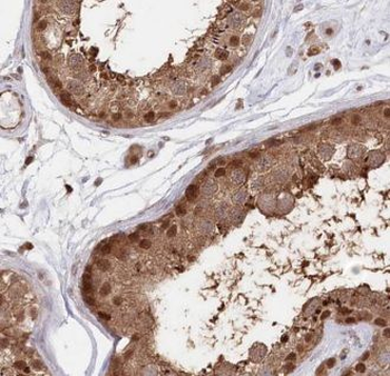 AKAP3 Rabbit Polyclonal Antibody