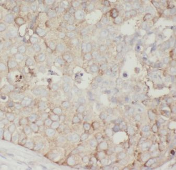 AKAP4 Rabbit Polyclonal Antibody