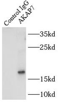 AKAP7 Antibody
