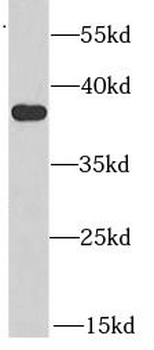 AKR1A1 Antibody