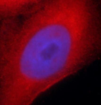 AKR1E2 Antibody
