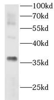 AKR1E2 Rabbit Polyclonal Antibody