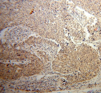 AKT1 Rabbit Polyclonal Antibody