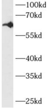 AKT1 Rabbit Polyclonal Antibody