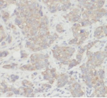 AKT1 Rabbit Polyclonal Antibody