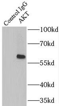 AKT1 Mouse Monoclonal Antibody