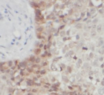 AKT1 Mouse Monoclonal Antibody
