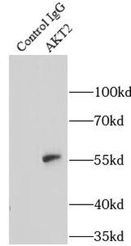 AKT2 Rabbit Polyclonal Antibody