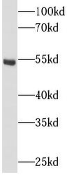 AKT2 Rabbit Polyclonal Antibody