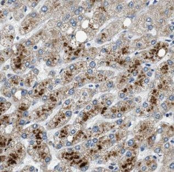AKT2 Rabbit Polyclonal Antibody