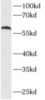 AKT3 Rabbit Polyclonal Antibody