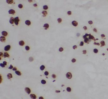AKT3 Rabbit Polyclonal Antibody