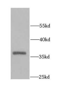 AKTIP Antibody