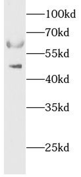 ALAS2 Antibody