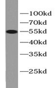 ALDH1A1 Rabbit Polyclonal Antibody