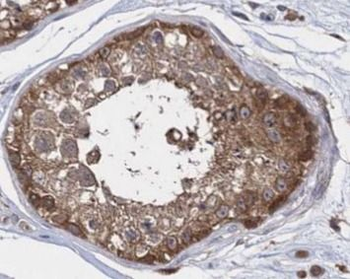 ALDH1A1 Rabbit Polyclonal Antibody