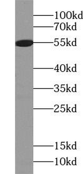 ALDH1B1 Rabbit Polyclonal Antibody
