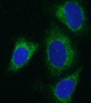 ALDH1B1 Antibody