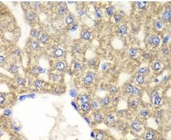 ALDH2 Rabbit Polyclonal Antibody