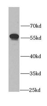 ALDH3A1 Rabbit Polyclonal Antibody