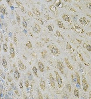 ALDH3A1 Rabbit Polyclonal Antibody