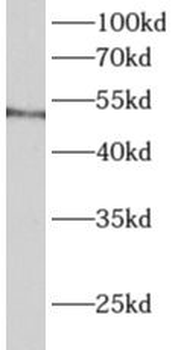 ALDH3B1 Rabbit Polyclonal Antibody