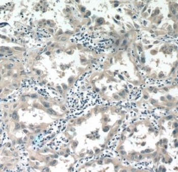 ALDH3B1 Rabbit Polyclonal Antibody