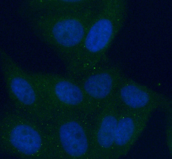 ALDH8A1 Antibody
