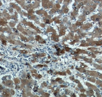 ALDH8A1 Rabbit Polyclonal Antibody