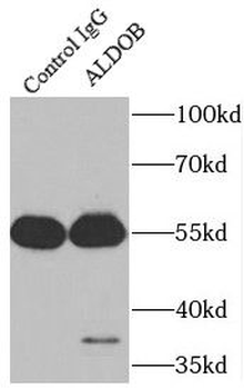 ALDOB Antibody