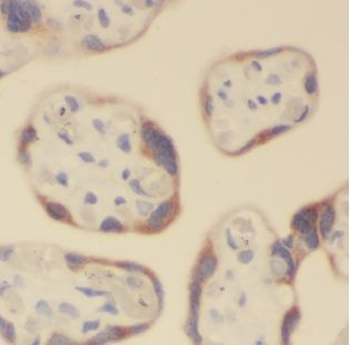 ALG5 Rabbit Polyclonal Antibody