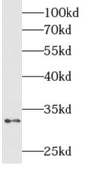 ALKBH4 Antibody