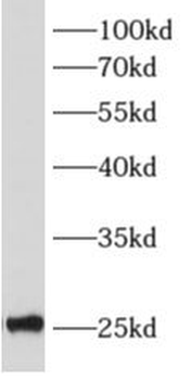 ALKBH7 Antibody