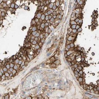 ALLC Rabbit Polyclonal Antibody