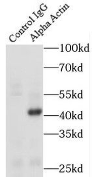 Alpha Actin Rabbit Polyclonal Antibody