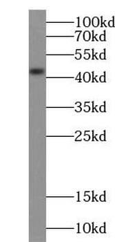 Alpha Actin Rabbit Polyclonal Antibody