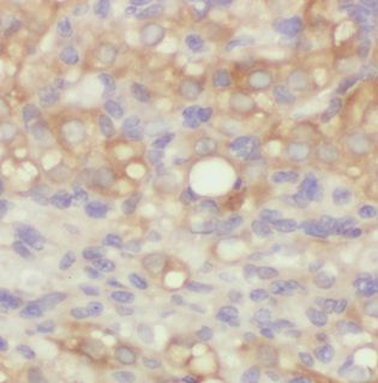 ADD1 Rabbit Polyclonal Antibody