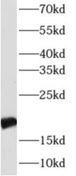 CRYAB Rabbit Polyclonal Antibody
