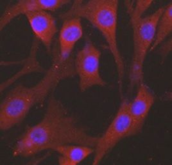 alpha Tubulin Antibody