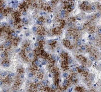 A2M Mouse Monoclonal Antibody