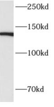 ALPK1 Rabbit Polyclonal Antibody