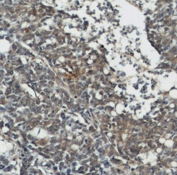 ALPL Rabbit Polyclonal Antibody