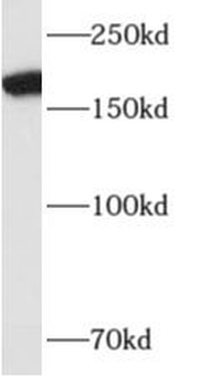 ALS2 Antibody