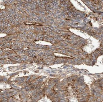 AMD1 Antibody