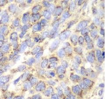 ACY1 Rabbit Polyclonal Antibody
