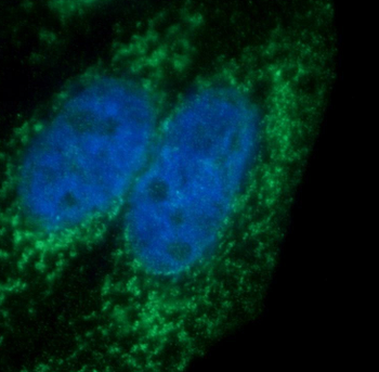 PRKAA1 Rabbit Polyclonal Antibody