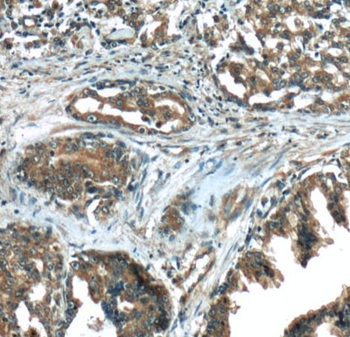 PRKAA1 Rabbit Polyclonal Antibody